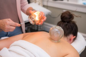 Image of patient undergoing cupping therapy.